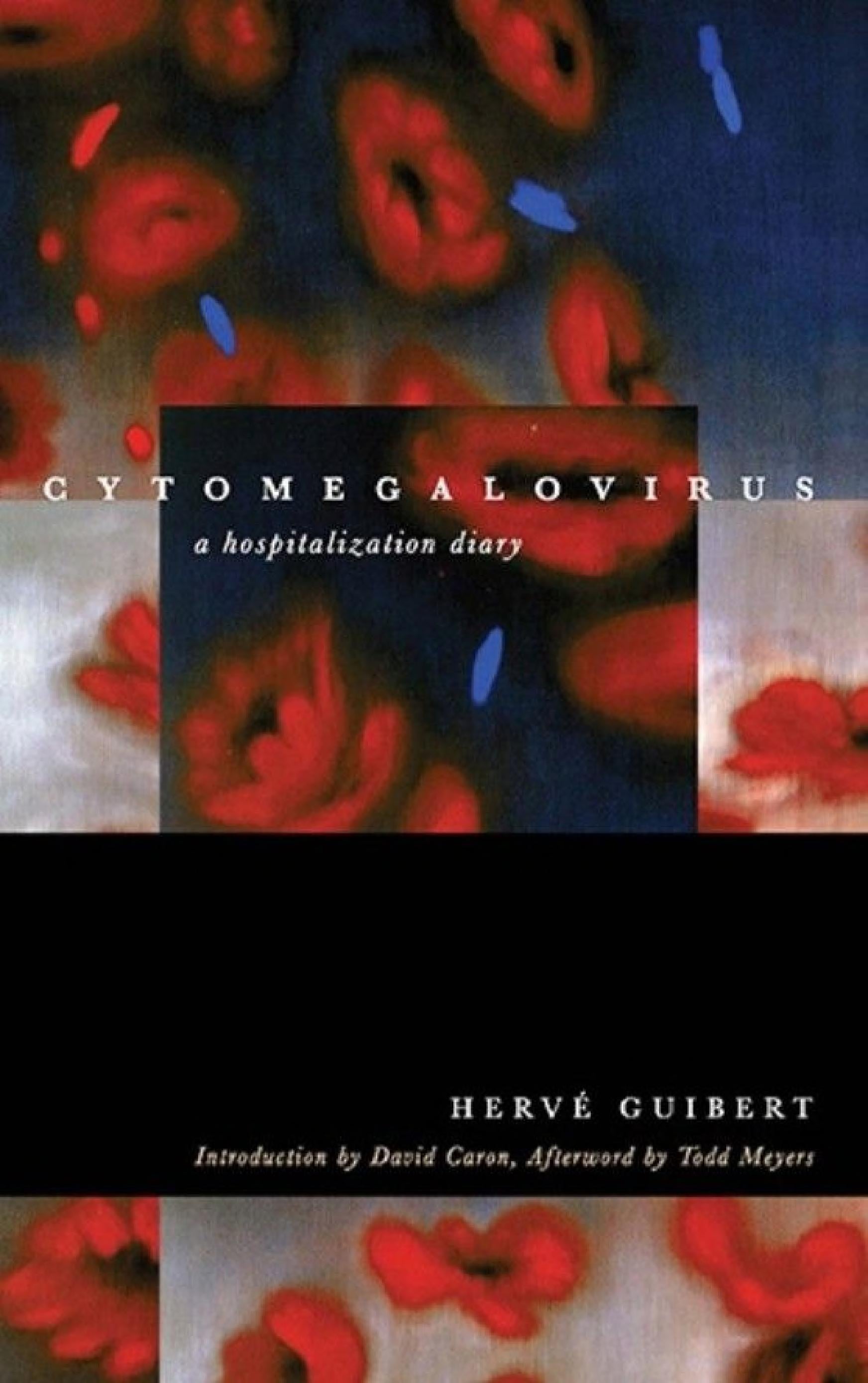 Cytomegalovirus - Cover